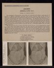 Abdomen. Abdominal Cavity - no. 5